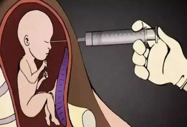 打胎真的有怨靈嗎-音狐運勢網